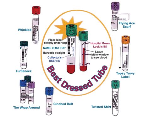 running and dropping test tube|Introduction to Specimen Collection .